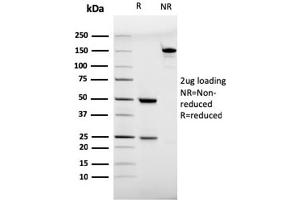SDS-PAGE Analysis Purified CD28 Mouse Monoclonal Antibody (C28/75). (CD28 Antikörper)