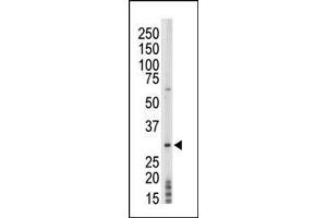 The anti-PRPK Pab (ABIN392682 and ABIN2842173) is used in Western blot to detect PRPK in mouse thymus tissue lysate. (TP53RK Antikörper  (AA 220-249))