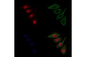 ABIN6263168 and ABIN6272598 staining Hela cells by IF/ICC. (MCM8 Antikörper  (C-Term))