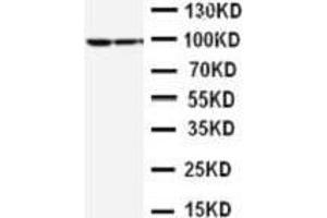 Anti-STAT1 antibody, Western blotting Lane 1: MCF-7 Cell Lysate Lane 2: HELA Cell Lysate