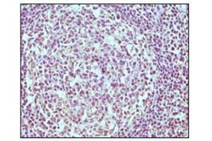 Immunohistochemistry (IHC) image for anti-CD19 Molecule (CD19) antibody (ABIN1105970)
