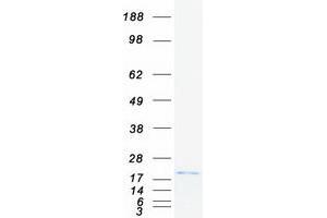 Western Blotting (WB) image for CD247 Molecule (CD247) (Transcript Variant 1) protein (Myc-DYKDDDDK Tag) (ABIN2713538)