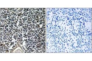 Immunohistochemistry analysis of paraffin-embedded human thymus gland, using ABCB7 Antibody. (ABCB7 Antikörper  (AA 691-740))