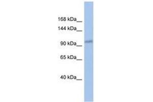 Image no. 1 for anti-DEAD (Asp-Glu-Ala-Asp) Box Polypeptide 24 (DDX24) (C-Term) antibody (ABIN6742691) (DDX24 Antikörper  (C-Term))