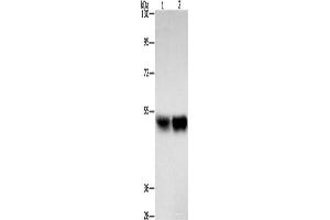 Western blot analysis of Hela cells A431 cells using ZFYVE19 Polyclonal Antibody at dilution of 1:500 (ZFYVE19 Antikörper)