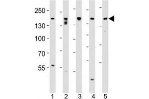 Western Blotting (WB) image for anti-Tuberous Sclerosis 2 (TSC2) (AA 1776-1805) antibody (ABIN3029331)