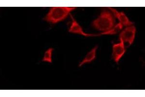 ABIN6276241 staining HeLa by IF/ICC. (OR10G4 Antikörper  (C-Term))