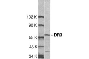 Image no. 1 for anti-Tumor Necrosis Factor Receptor Superfamily, Member 25 (TNFRSF25) (AA 398-417) antibody (ABIN201325) (DR3/LARD Antikörper  (AA 398-417))