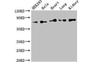 Western Blot Positive WB detected in: HEK293 whole cell lysate, Hela whole cell lysate, Mouse heart tissue, Mouse lung tissue, Mouse kidney tissue All lanes: FOXK1 antibody at 2. (Foxk1 Antikörper  (AA 621-730))