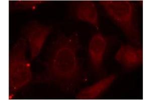Image no. 1 for anti-Neurofibromin 2 (NF2) (pSer518) antibody (ABIN197028) (Merlin Antikörper  (pSer518))