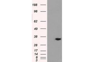 Western Blotting (WB) image for anti-Aldo-Keto Reductase Family 1, Member A1 (Aldehyde Reductase) (AKR1A1) antibody (ABIN1496541) (AKR1A1 Antikörper)