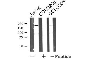 Western blot analysis of extracts from Jurkat/COLO205 cells, using MRCKa antibody. (CDC42BPA Antikörper  (Internal Region))