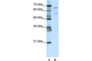 Western Blotting (WB) image for anti-TAF6-Like RNA Polymerase II, P300/CBP-Associated Factor (PCAF)-Associated Factor, 65kDa (TAF6L) antibody (ABIN2461793) (TAF6L Antikörper)