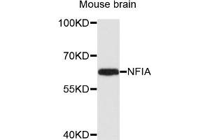 Western blot analysis of extracts of mouse brain cells, using NFIA antibody. (NFIA Antikörper)