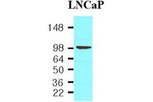 Western blot analysis: Cell lysates of LNCaP(30ug) were resolved by SDS-PAGE, transferred to NC membrane and probed with anti-human PSMA (1:1,000). (PSMA Antikörper)