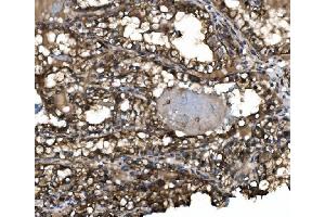IHC analysis of Claudin 3/CLDN3 using anti-Claudin 3/CLDN3 antibody (ABIN7599626). (Claudin 3 Antikörper  (AA 101-220))
