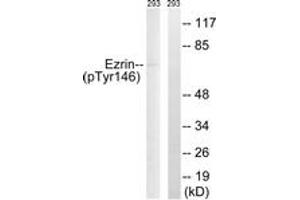 Western blot analysis of extracts from 293 cells treated with UV 15', using Ezrin (Phospho-Tyr146) Antibody. (Ezrin Antikörper  (pTyr146))