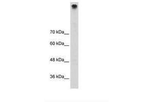 Image no. 1 for anti-Transient Receptor Potential Cation Channel, Subfamily M, Member 3 (TRPM3) (AA 666-715) antibody (ABIN203318) (TRPM3 Antikörper  (AA 666-715))