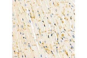 Immunohistochemistry (Paraffin-embedded Sections) (IHC (p)) image for anti-Cadherin 19 (CDH19) antibody (ABIN7073258)