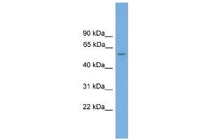 WB Suggested Anti-Toe1 Antibody Titration: 0. (TOE1 Antikörper  (Middle Region))