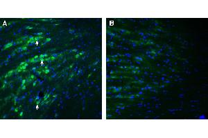Expression of PACC1 in mouse reticular thalamic nucleus. (PACC1 (AA 95-110), (Extracellular) Antikörper)