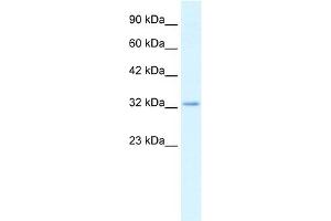 WB Suggested Anti-CLDN10 Antibody Titration:  2. (CLDN10 Antikörper  (C-Term))