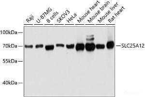 Western blot analysis of extracts of various cell lines using SLC25A12 Polyclonal Antibody at dilution of 1:3000.