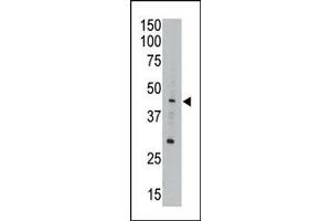 The anti-CEM15 Pab (ABIN388141 and ABIN2846472) is used in Western blot to detect CEM15 in A549 cell lysate. (APOBEC3G Antikörper  (AA 118-148))