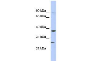 WB Suggested Anti-MYD88 Antibody Titration: 0. (MYD88 Antikörper  (N-Term))