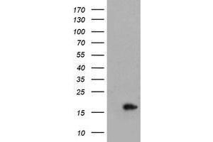 Image no. 1 for anti-Cellular Retinoic Acid Binding Protein 2 (CRABP2) antibody (ABIN1497621) (CRABP2 Antikörper)