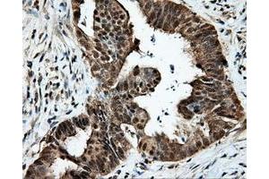 Image no. 9 for anti-Tubulin tyrosine Ligase-Like Family, Member 12 (TTLL12) antibody (ABIN1499035) (TTLL12 Antikörper)