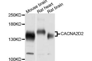 Western blot analysis of extracts of various cell lines, using CACNA2D2 antibody (ABIN5997344) at 1/1000 dilution. (CACNA2D2 Antikörper)
