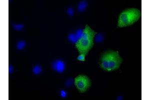 Image no. 2 for anti-Transforming, Acidic Coiled-Coil Containing Protein 3 (TACC3) antibody (ABIN1498096) (TACC3 Antikörper)