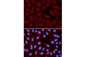 Immunofluorescence (IF) image for anti-Surfactant Protein C (SFTPC) antibody (ABIN1874760) (Surfactant Protein C Antikörper)