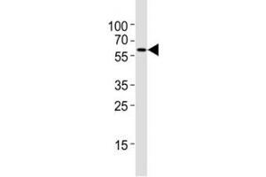 Western blot testing of Atg5 antibody at 1:4000 dilution + NIH3T3 lysate