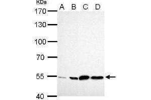 WB Image ALDH2 antibody detects ALDH2 protein by Western blot analysis.
