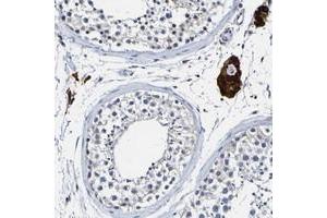 Immunohistochemical staining of human testis with LOC203547 polyclonal antibody  shows strong cytoplasmic positivity in Leydig cells.
