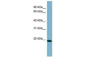 TIRAP antibody used at 1 ug/ml to detect target protein.