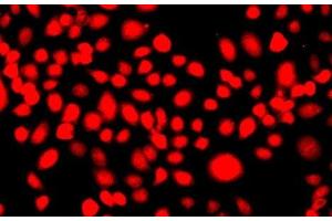 Immunofluorescence analysis of A549 cells using IFRD1 Polyclonal Antibody (IFRD1 Antikörper)