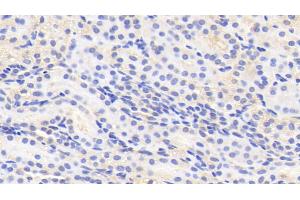 Immunohistochemistry (IHC) image for anti-Purine-Rich Element Binding Protein A (PURA) (AA 1-322) antibody (ABIN7444490)