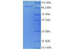 SDS-PAGE (SDS) image for Nuclear RNA Export Factor 3 (NXF3) (AA 1-531), (full length) protein (His-SUMO Tag) (ABIN5710037) (NXF3 Protein (AA 1-531, full length) (His-SUMO Tag))