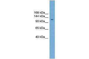 WB Suggested Anti-LIG1  Antibody Titration: 0. (LIG1 Antikörper  (Middle Region))