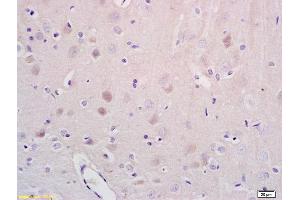 Formalin-fixed and paraffin embedded rat brain tissue labeled with Anti-NR1D1/REV-ERB alpha Polyclonal Antibody, Unconjugated (ABIN700854) at 1:200 followed by conjugation to the secondary antibody and DAB staining (NR1D1 Antikörper)