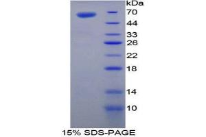 SDS-PAGE (SDS) image for Transglutaminase 1, Keratinocyte (TGM1) (AA 337-607) protein (His tag,GST tag) (ABIN2123705)