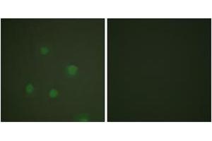 Immunofluorescence analysis of A549 cells, using Progesterone Receptor (Ab-400) Antibody.