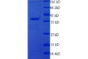 SDS-PAGE (SDS) image for Thrombospondin 1 (THBS1) (AA 19-350) protein (His tag) (ABIN5712522)
