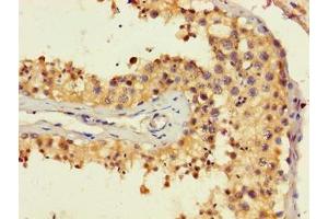 Immunohistochemistry of paraffin-embedded human testis tissue using ABIN7167887 at dilution of 1:100 (MEST Antikörper  (AA 1-325))