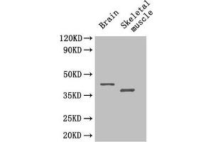 Western Blot Positive WB detected in: Mouse brain tissue, Mouse skeletal muscle tissue All lanes: SEPP1 antibody at 4 μg/mL Secondary Goat polyclonal to rabbit IgG at 1/50000 dilution Predicted band size: 43 kDa Observed band size: 43, 40 kDa (Selenoprotein P (SELENOP) (AA 20-381) Antikörper)