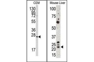 Image no. 1 for anti-Gremlin 1 (GREM1) (C-Term) antibody (ABIN358612) (GREM1 Antikörper  (C-Term))