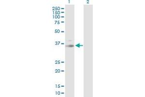 Western Blot analysis of PRKG1 expression in transfected 293T cell line by PRKG1 MaxPab polyclonal antibody. (PRKG1 Antikörper  (AA 1-312))